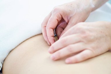Akupunktur ve moxibustion tedavi ile tedavi altına kadın