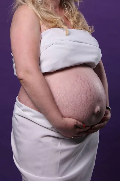 Rozstępy skóry brzucha w czasie ciąży. Duży brzuch Kobieta w ciąży zbliżenie. Koncepcja piękna i zdrowia kobiety podczas ciąży. — Zdjęcie stockowe