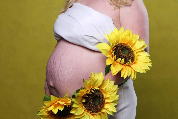 Marcas de estiramento da pele do abdômen durante a gravidez. Mulher grávida barriga grande close-up. O conceito de beleza e saúde de uma mulher durante a gravidez . — Fotografia de Stock