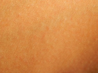 İnsan cilt dokusunu vücudun çeşitli yerlerinde