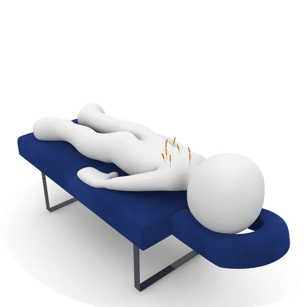 get acupuncture treatment with alternativ medicine