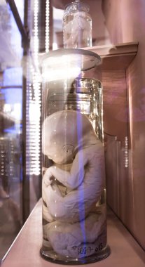 St. Petersburg, Rusya Federasyonu-Ekim 08, 2016: Antropoloji Müzesi ve Etnografya Kunstkammer, sergiler. Embriyo bankalarda.