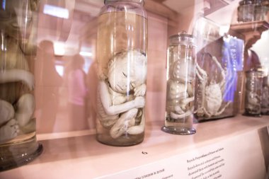 St. Petersburg, Rusya Federasyonu-Ekim 08, 2016: Antropoloji Müzesi ve Etnografya Kunstkammer, sergiler. Embriyo bankalarda.