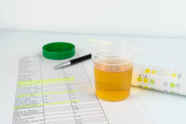 Kontrol edin, rutin idrar tahlili, idrar tahlili için ayırıcı. 