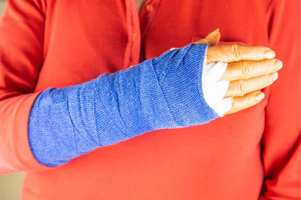 Mulher Camisola Vermelha Com Mão Recém Operada Com Bandagem Azul — Fotografia de Stock