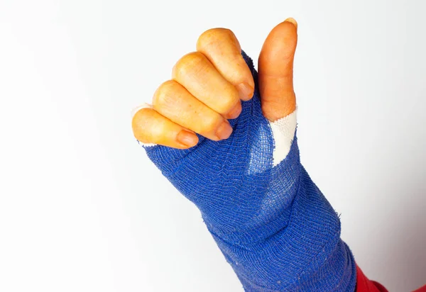 新鲜操作的手与蓝色绷带和消毒剂橙色手指 竖起大拇指 — 图库照片
