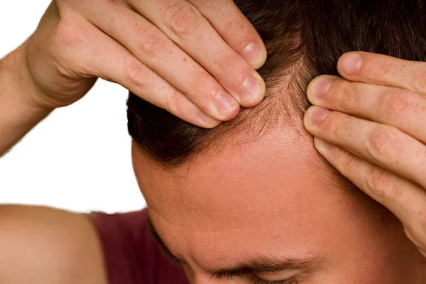 Adam ellerini kafasına saç yayılır. Erkeklerde saç dökülmesi sorunu.