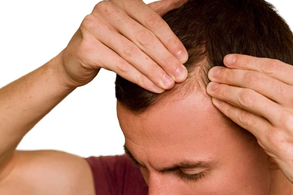 Tipo Espalha Cabelo Cabeça Com Mãos Problema Perda Cabelo Homens — Fotografia de Stock