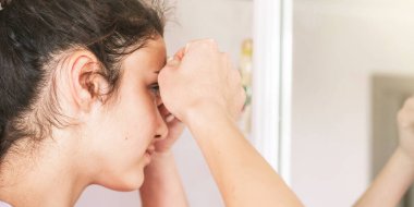 Genç kız alnında sivilceler açıyor, parmakları yakın çekimde.