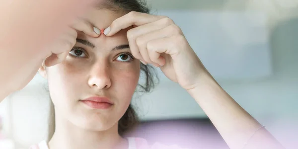 teenager girl pops pimples on forehead by fingers closeup