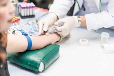 Bir damar, damar hastalığı kan testi ile teşhis edilmesine, kan testleri, araştırma laboratuarı gerçek kan örnekleri analiz alarak hemşire kan örneğinden,