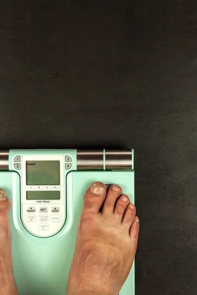 Concepto de obesidad. Peso digital moderno y piernas. Control de peso en la dieta . — Foto de Stock