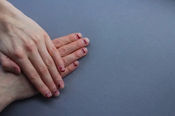 Flisas, stratifierat naglar. naglar efter gel Polish. slarviga händer på en grå background.the utsikt från toppen — Stockfoto