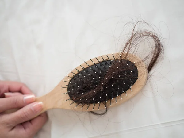 Escova Cabelo Mão Das Mulheres Com Perda Cabelo Caspa Problemas — Fotografia de Stock