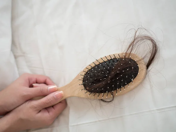 Hair Loss Problem Concept — Stock Photo, Image