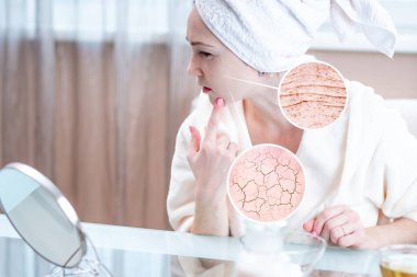 Onun baş Kuru cildi ilk kırışıklık ve çatlaklar ile görünümlü bir havlu ile güzel genç kadın. Daireler bir büyüteç büyüteç gibi cilt artırın