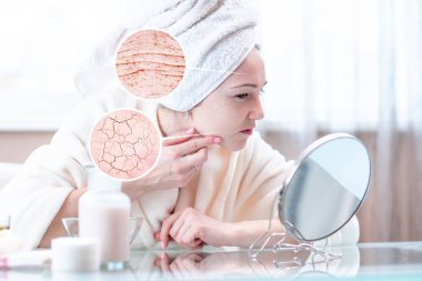 Onun baş Kuru cildi ilk kırışıklık ve çatlaklar ile görünümlü bir havlu ile güzel genç kadın. Daireler bir büyüteç büyüteç gibi cilt artırın