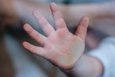Çocuğun küçük eli yansıma ile pencere camı üzerine bastırılır. Çocukların yalnızlığı. Yetimhane ve yetimler