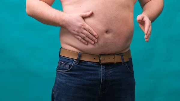 Macho con un vientre grande muestra su grasa en una pantalla verde. El concepto de alimentación saludable y pérdida de peso, dieta — Foto de Stock