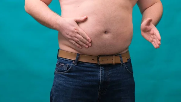 Macho con un vientre grande muestra su grasa en una pantalla verde. El concepto de alimentación saludable y pérdida de peso, dieta — Foto de Stock