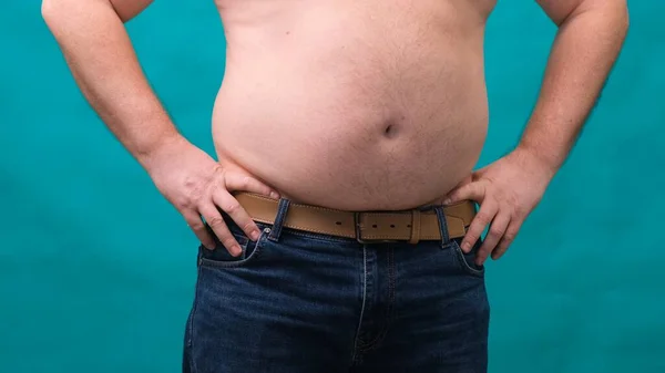 Rüde mit dickem Bauch zeigt sein Fett auf einem grünen Bildschirm. Das Konzept der gesunden Ernährung und Abnehmen, Ernährung — Stockfoto