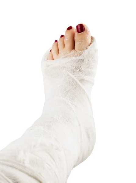 Broken woman leg in gypsum bandage — Stock Photo, Image