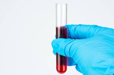 Elinde mavi kauçuk eldiven kapatalım. Doktor bir cam tüp kan tutar. Bir laboratuvar asistanı, fotoğrafın sağ elinde analiz eder. Beyaz arka plan, imza, boşaltmak için yer