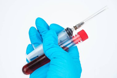  Doktor elinde kan ile tüp. Tıbbi teknisyen mavi Medikal eldiven closeup içinde. Sağdaki fotoğraf doktorun elinde analiz eder. Beyaz arka plan, imza, boşaltmak için yer