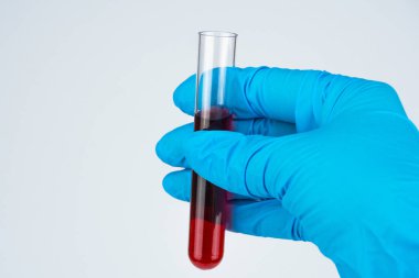 Tıbbi mavi eldiven elinde kapatın. Laboratuar asistanı bir cam tüp kan ile elinde tutuyor. Sağdaki fotoğraf doktorun elinde analiz eder. Beyaz arka plan, imza, boşaltmak için yer