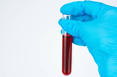 Tüp kan testleri için doktorun elinde sınayın. Tıbbi teknisyen mavi Medikal eldiven closeup içinde. Sağdaki fotoğraf doktorun elinde analiz eder. Beyaz arka plan, imza, boşaltmak için yer