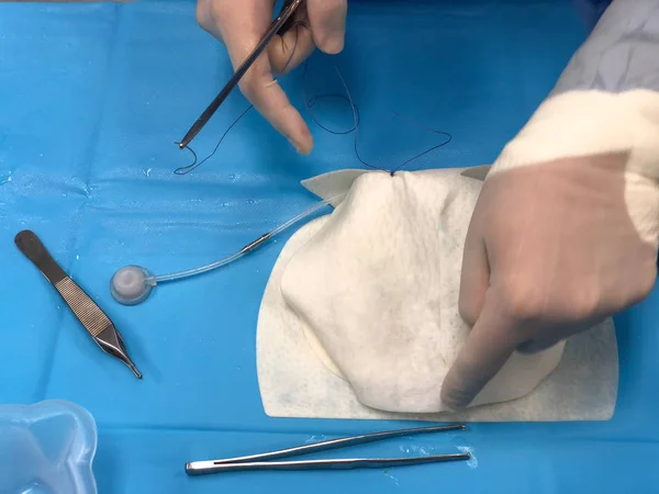 Surgeon Wearing Gloves Suturing Together Prosthesis Insert Implant Showing Surgical — Stock Photo, Image