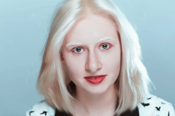 Porträt Eines Blonden Albino Mädchens Studio — Stockfoto