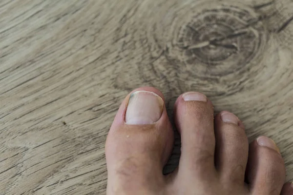 木製の堅木の床の上の白い足の男性の爪 — ストック写真