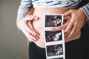 Hamile bir çiftin bir ultrason karnına tutan eller