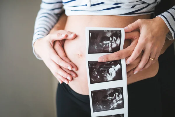 Manos Una Pareja Embarazada Sosteniendo Imágenes Ultrasonido Vientre —  Fotos de Stock