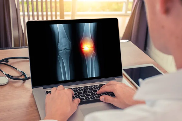 Doktor ağrı diz ile ilgili bir x-ray izliyor. Radyoloji kavramı