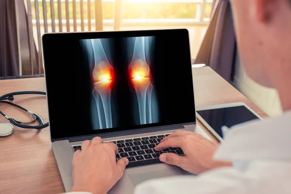 Arts kijken een x-ray over pijn in de knieën. Radiologie concept — Stockfoto