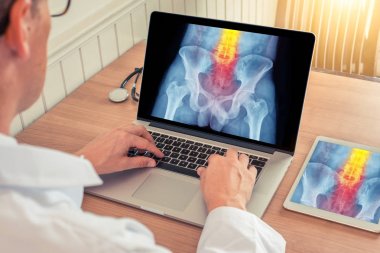 Doktor bir tıp ofisinde omurgaüzerinde ağrı kesici ile kalça x-ray ile bir dizüstü bilgisayar ve dijital tablet izliyor