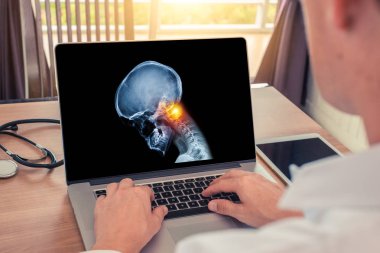 Doktor, boynunun üst kısmında ağrı olan kafatası röntgeni olan bir dizüstü bilgisayarı izliyor. Migren baş ağrısı veya travma kavramı.