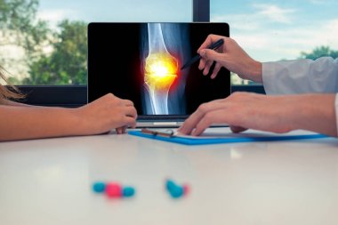 Doktor bir kadın hastaya bir dizüstü bilgisayar üzerinde diz ağrısı ile bacak röntgeni gösteriyor. Masadaki haplar