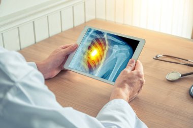 Doktor kalp ağrısı ile göğüs röntgeni ile bir dijital tablet tutan. Kalp krizi kavramı