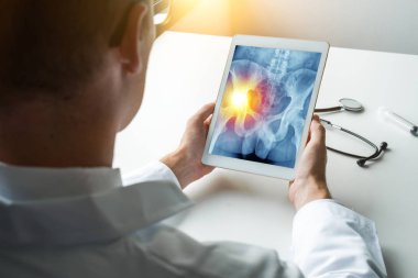 Doktor sol ağrı ile kalça x-ray ile dijital bir tablet tutan
