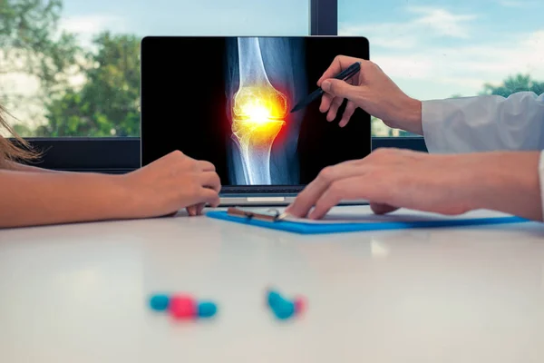 Doktor bir kadın hastaya bir dizüstü bilgisayar üzerinde diz ağrısı ile bacak röntgeni gösteriyor. Masadaki haplar
