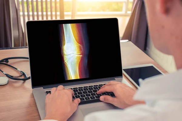 Doktor, kemiklerinde ağrı olan bacak röntgeni olan bir dizüstü bilgisayarı izliyor. Radyoloji kavramı