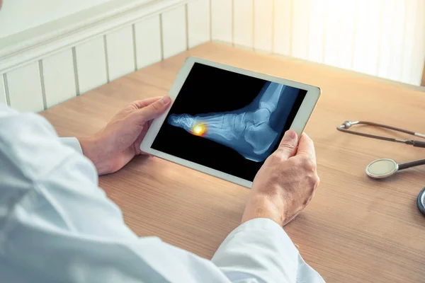 Doktor ayak altında ağrı ile x-ray ile dijital bir tablet tutan