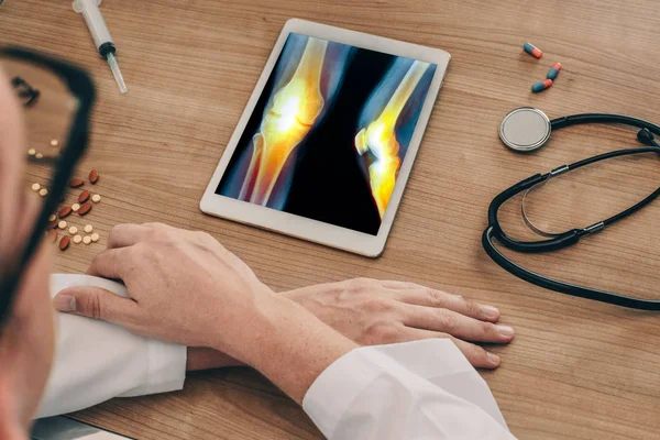 Doctor watching a digital tablet with x-ray of legs with pain in the bones