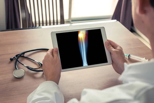 Arts met een digitale tablet met x-ray van been en pijn op de externe knie. Zijaanzicht vooraan — Stockfoto