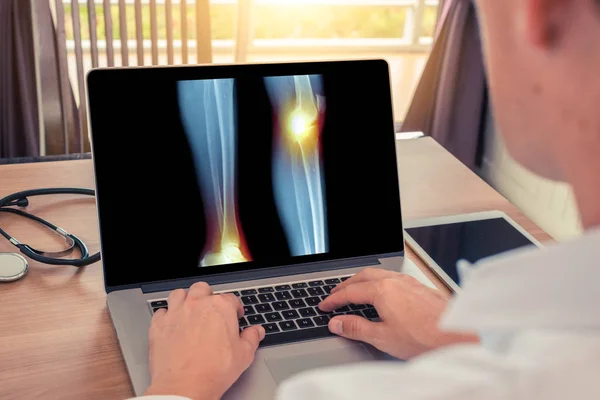 Doktor diz ve ayak bileğinde ağrı ile bacaklar x-ray ile bir dizüstü izliyor. Radyoloji kavramı