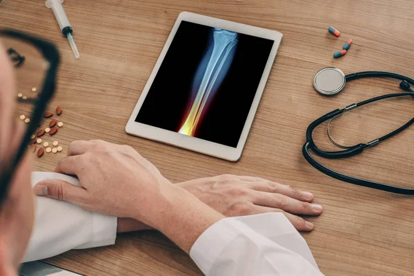 Doktor ayak bileğinde ağrı ile bacak röntgeni ile dijital tablet izliyor