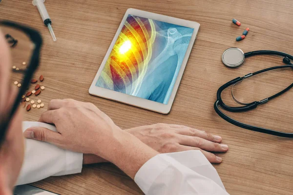 Doktor kalp ağrısı ile göğüs röntgeni ile bir dijital tablet izliyor. Kalp krizi kavramı